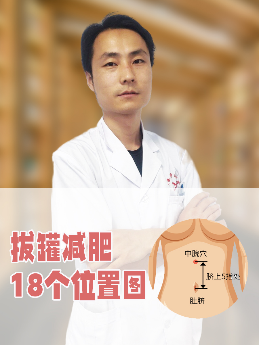 拔罐减肥18个位置图
