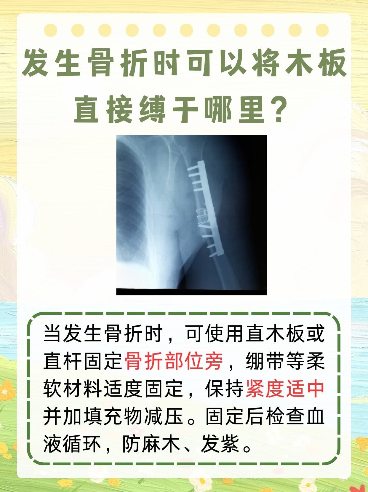 发生骨折时可以将木板直接缚于哪里？揭秘