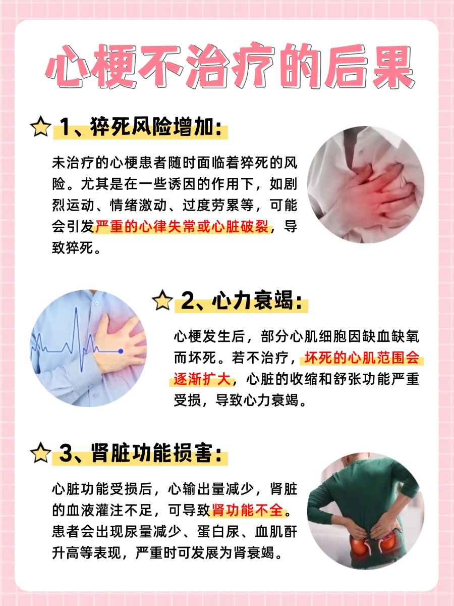 医生视角：心肌梗塞的治疗策略