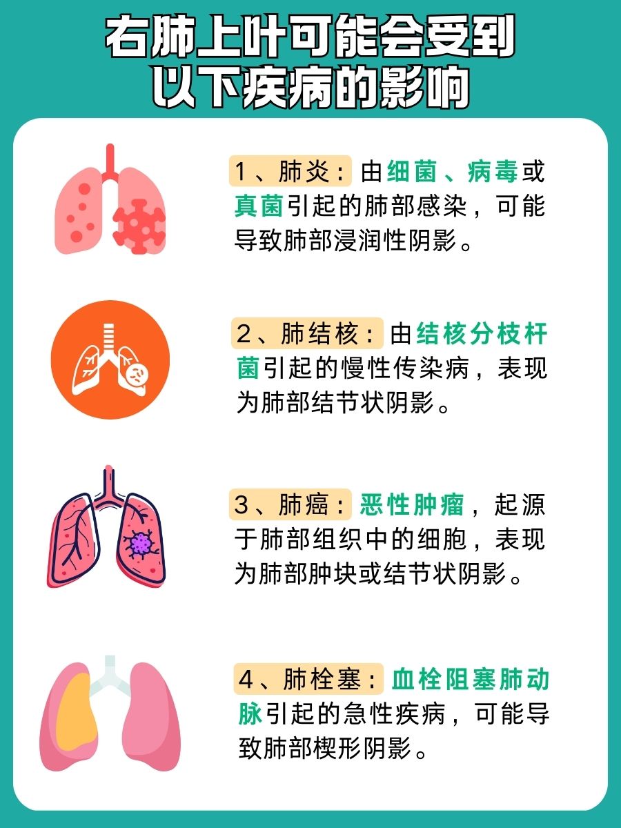 认识右肺上叶：一文解析