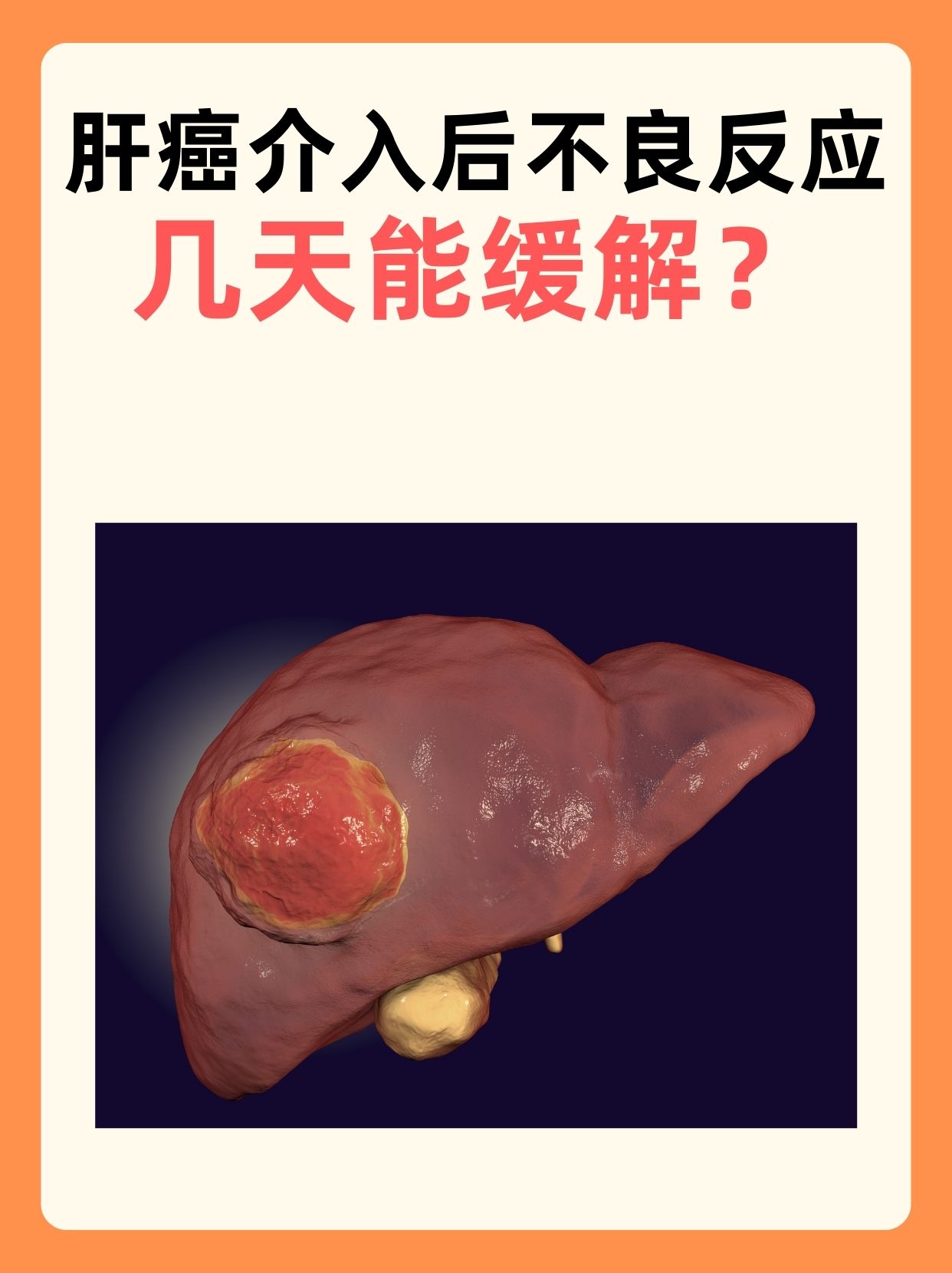 肝癌介入后不良反应:几天能缓解?