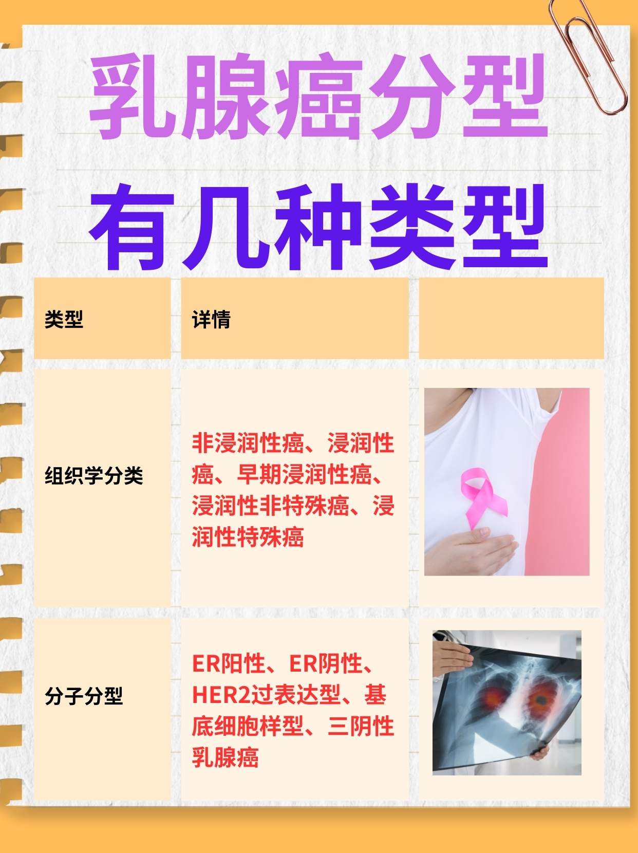 医生揭秘：乳腺癌分型有几种类型