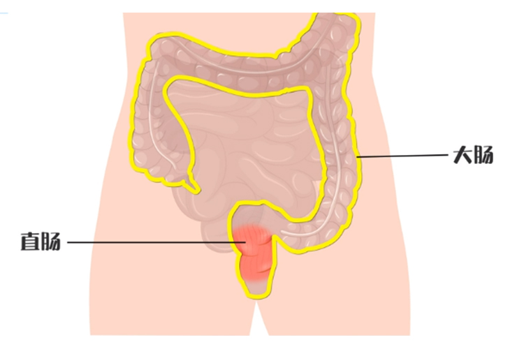 直肠位置图 直肠位置图