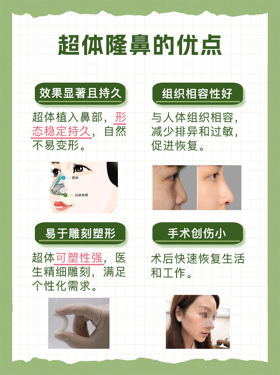 深度剖析超体隆鼻的优点和缺点
