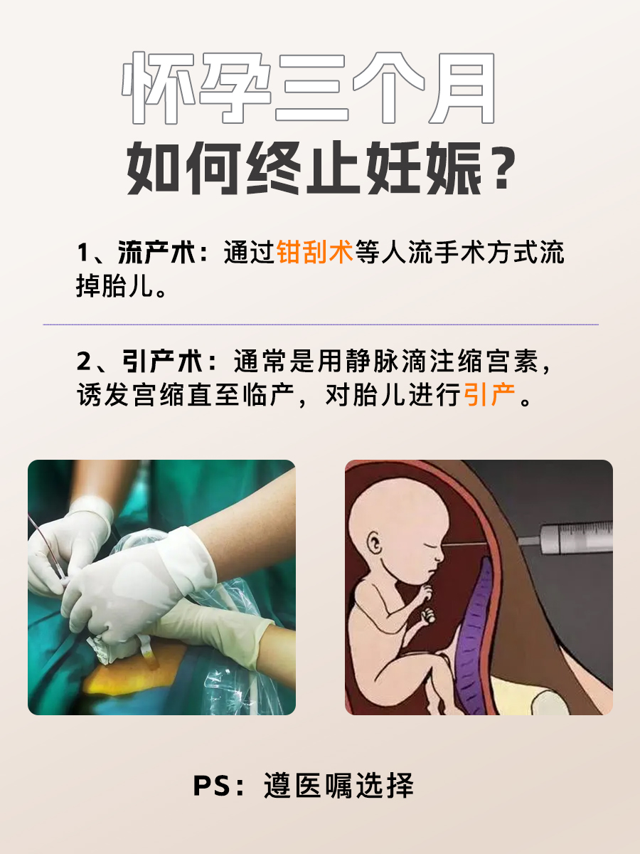 怀孕三个月能做无痛人流手术吗，一文解析