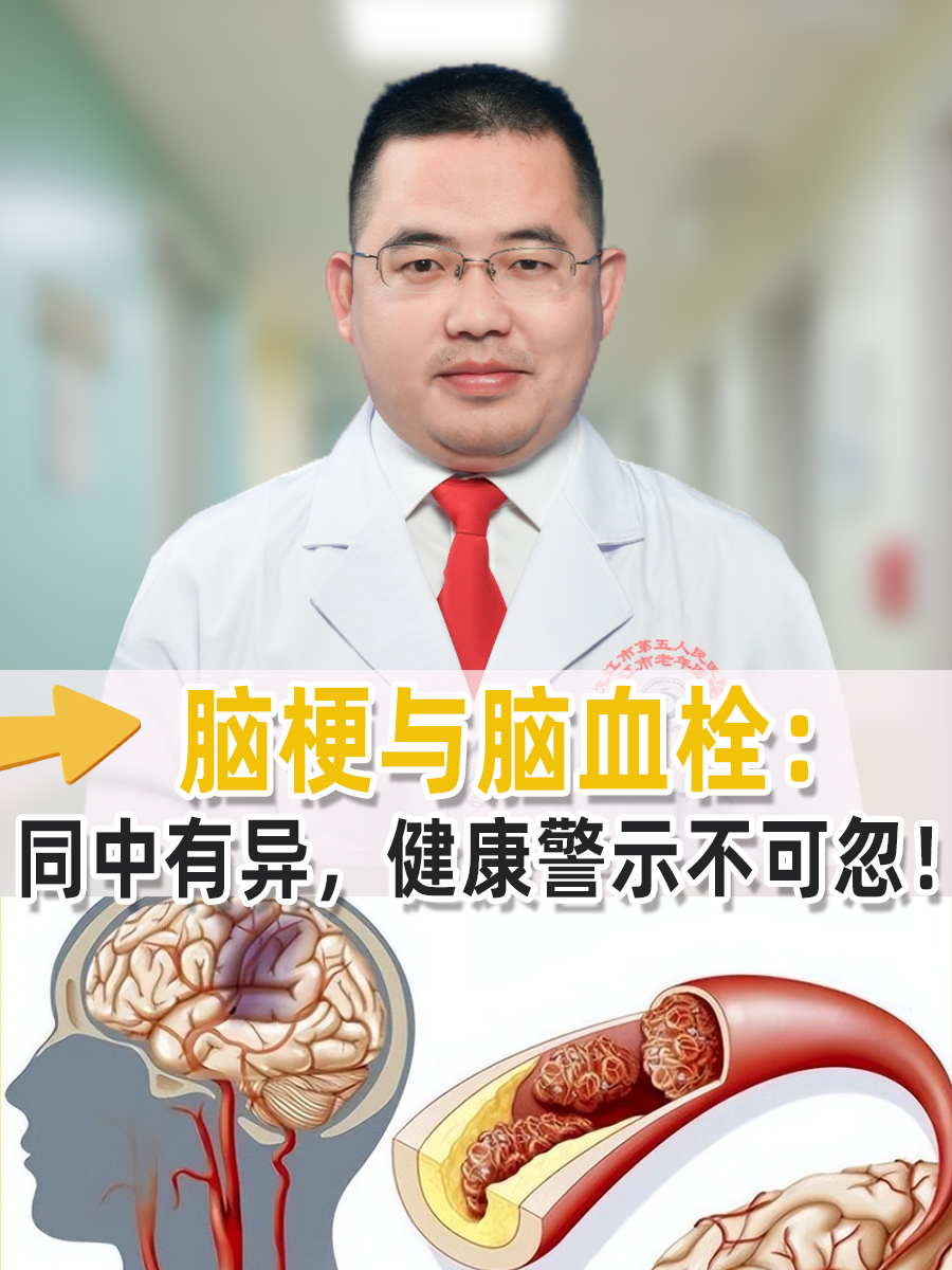 脑梗与脑血栓：同中有异，健康警示不可忽！