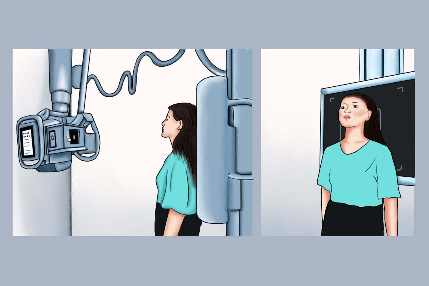 颈椎正位摆位图