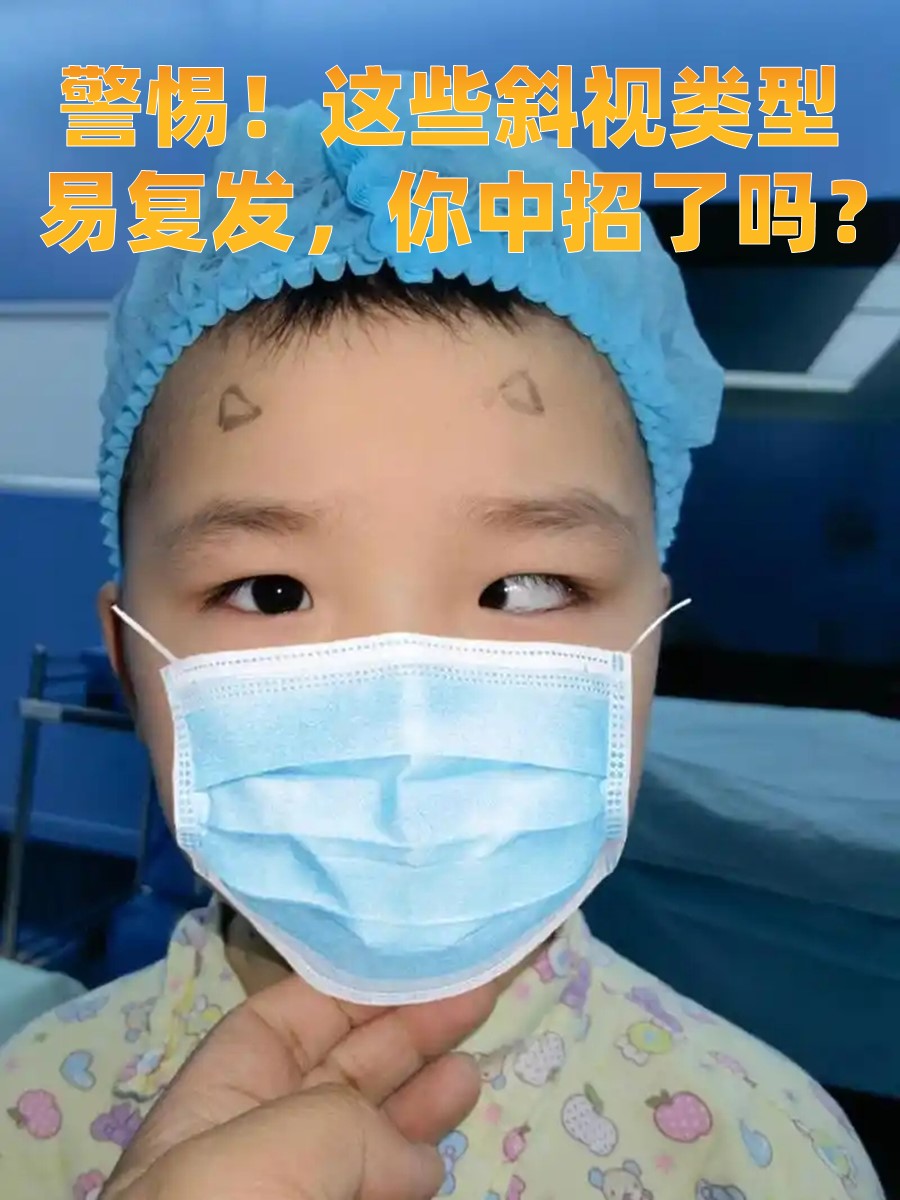 警惕！这些斜视类型易复发，你中招了吗？