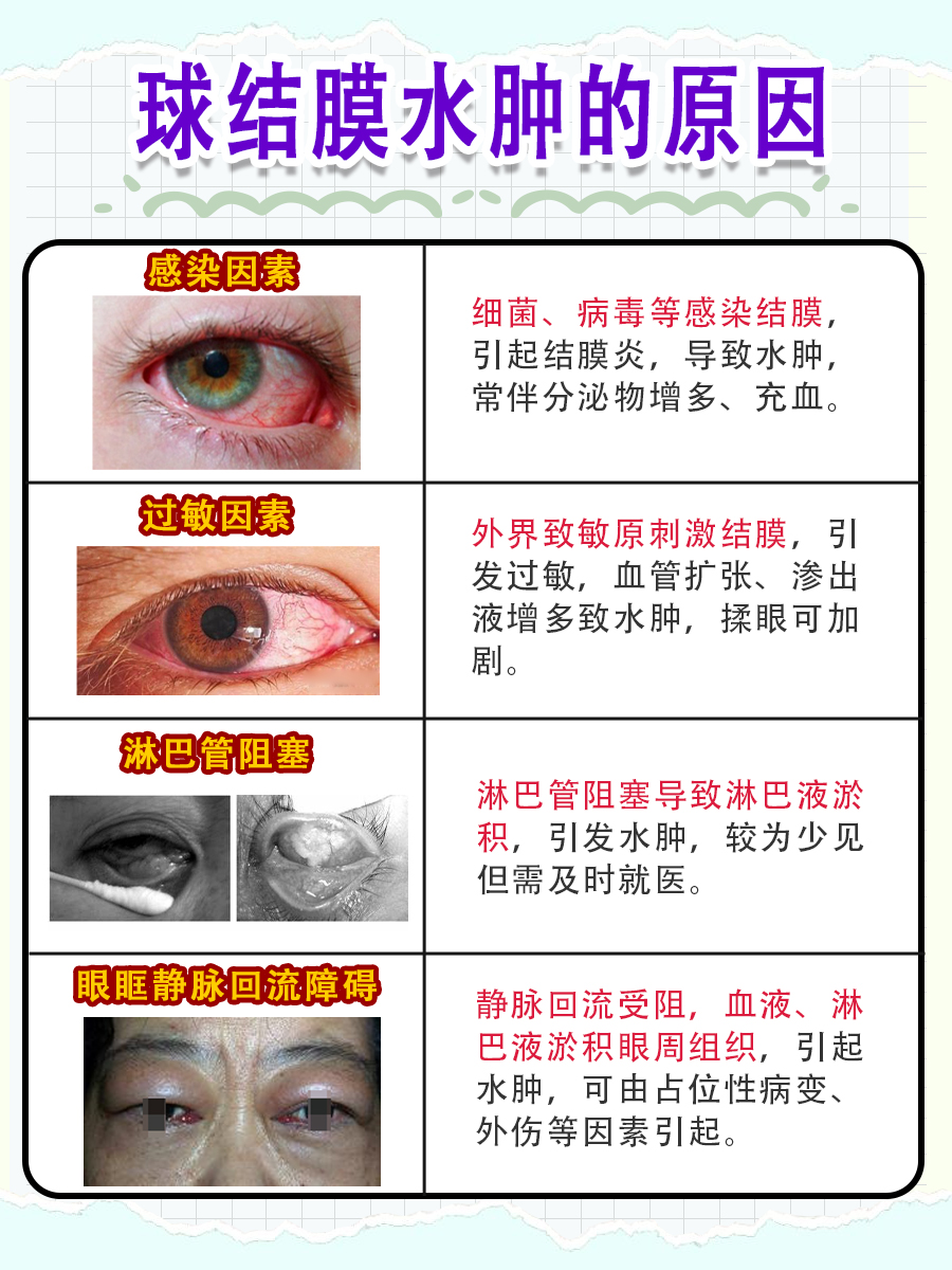 眼球SOS！球结膜水肿的原因，你了解几个？