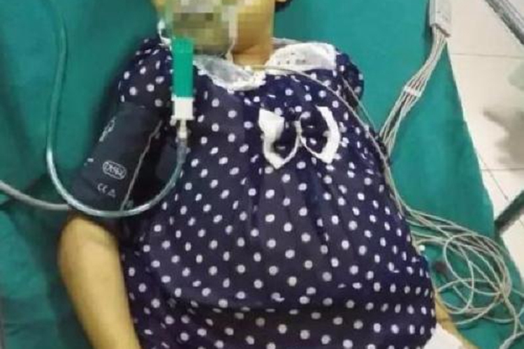 地中海贫血黄疸图 地中海贫血黄疸图