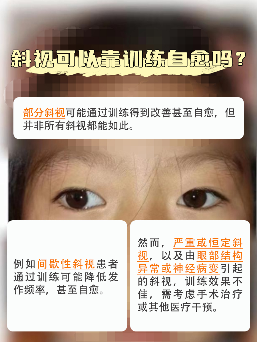 斜视自愈？训练能否让眼睛回归正轨