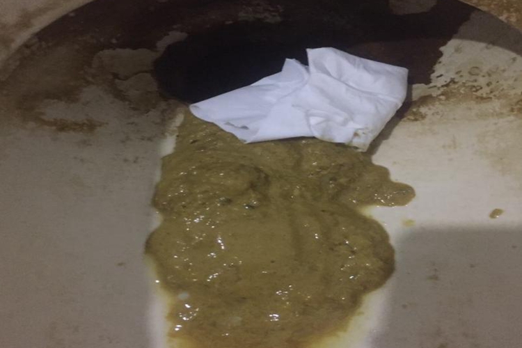 宝宝腹泻黄绿色稀便图