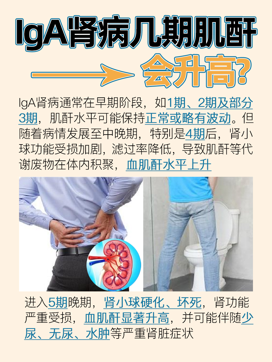 IgA肾病:肌酐上涨在哪期?必看!
