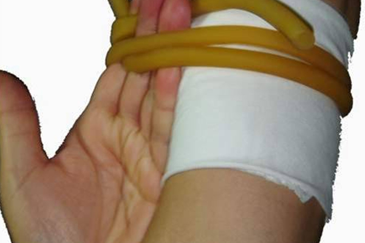 止血带加压止血图