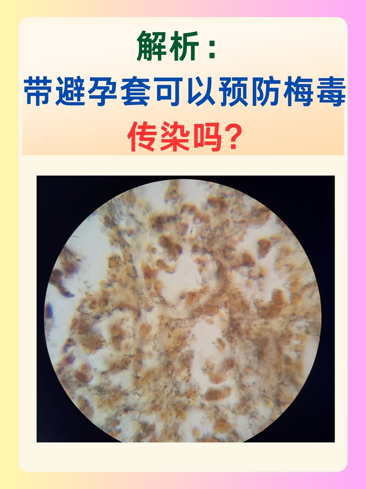 解析：带避孕套可以预防梅毒传染吗