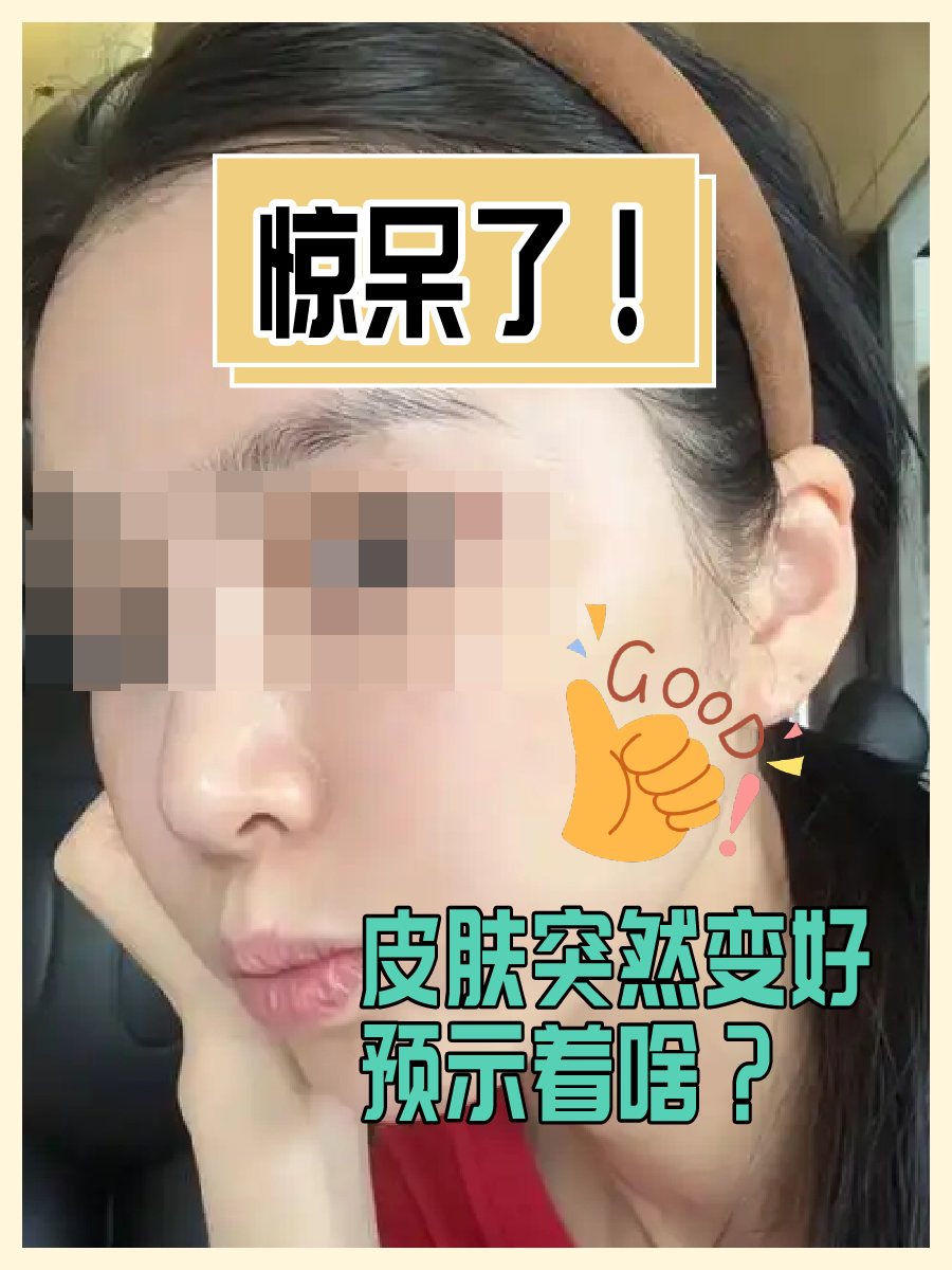 惊呆了!皮肤突然变好,预示着啥?