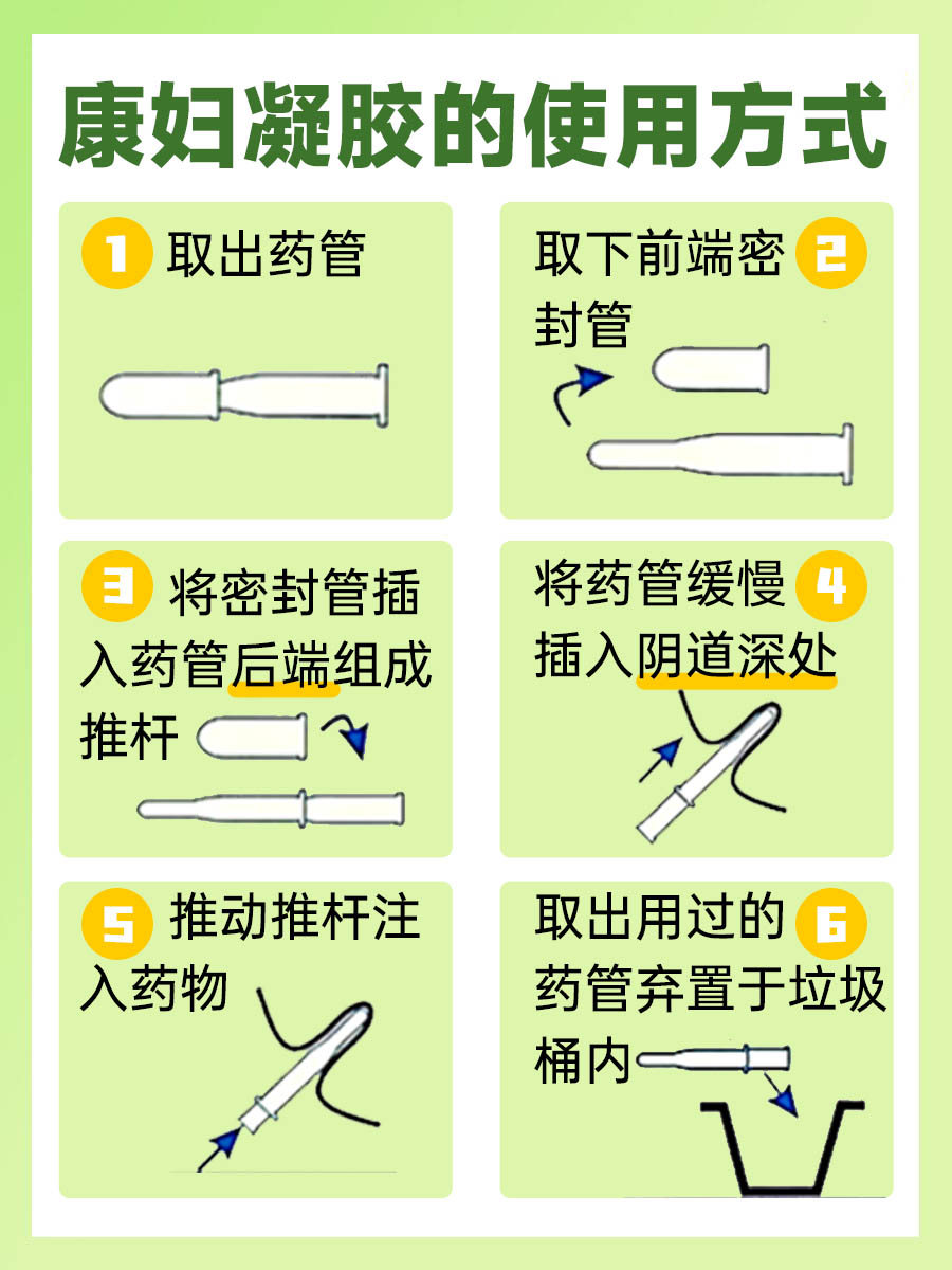 解答：使用康妇凝胶第二天后可以同房吗