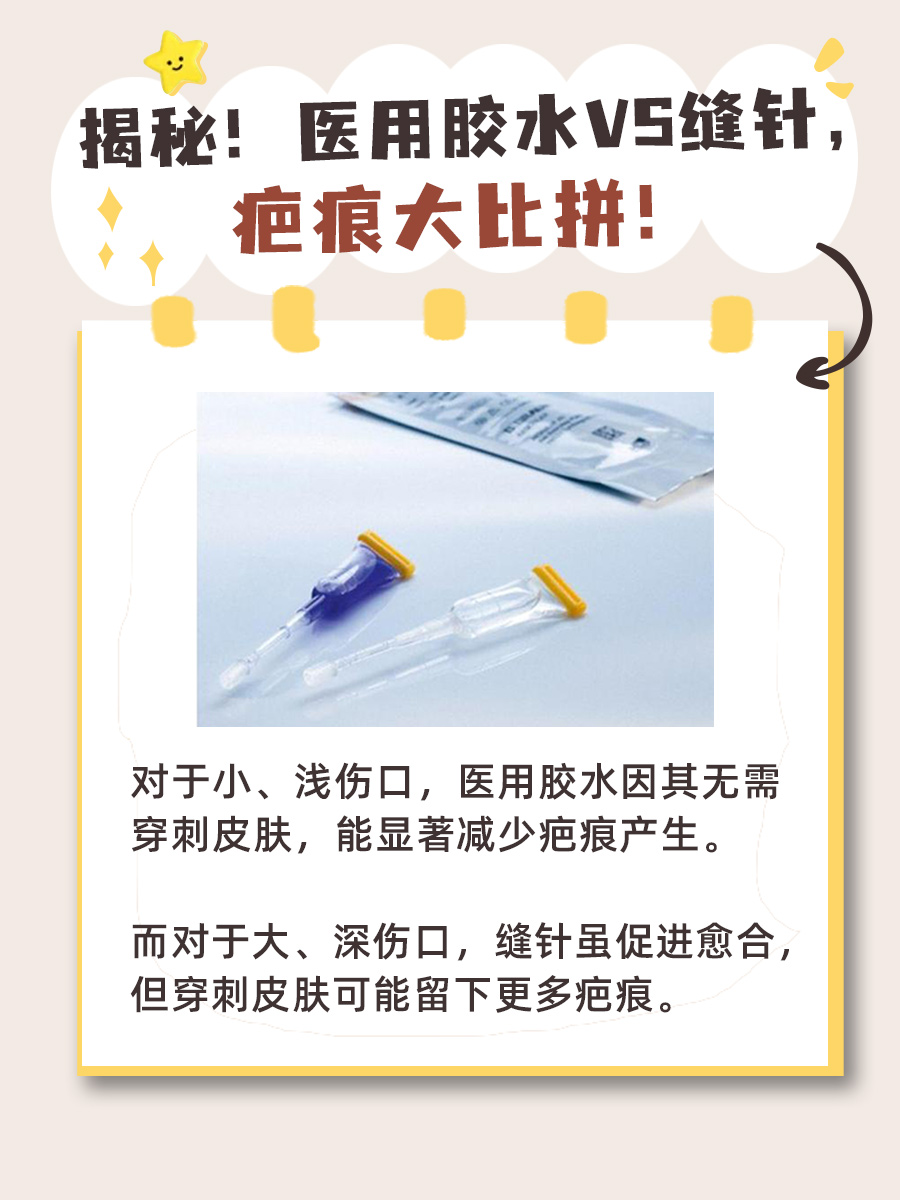 揭秘！医用胶水VS缝针，疤痕大比拼！