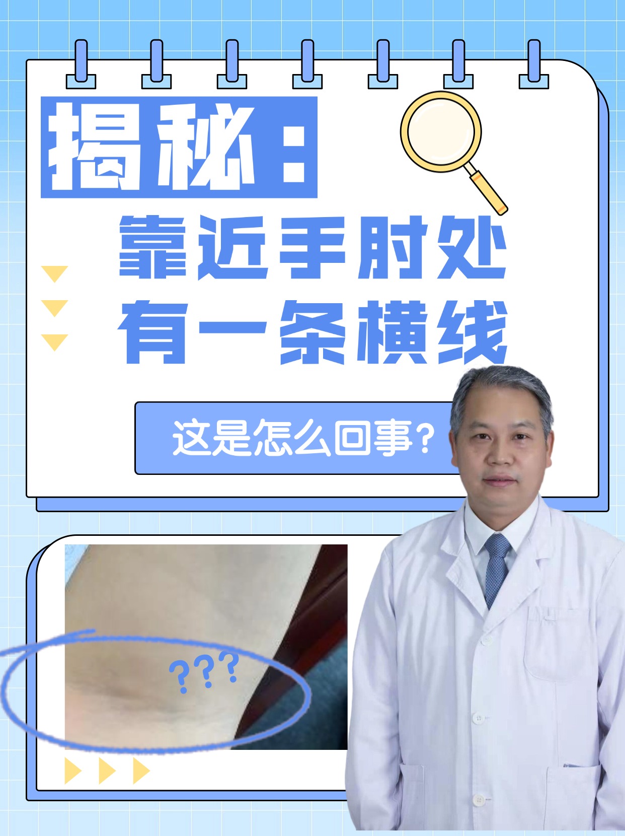 揭秘:靠近手肘处有一条横线,这是怎么回事?