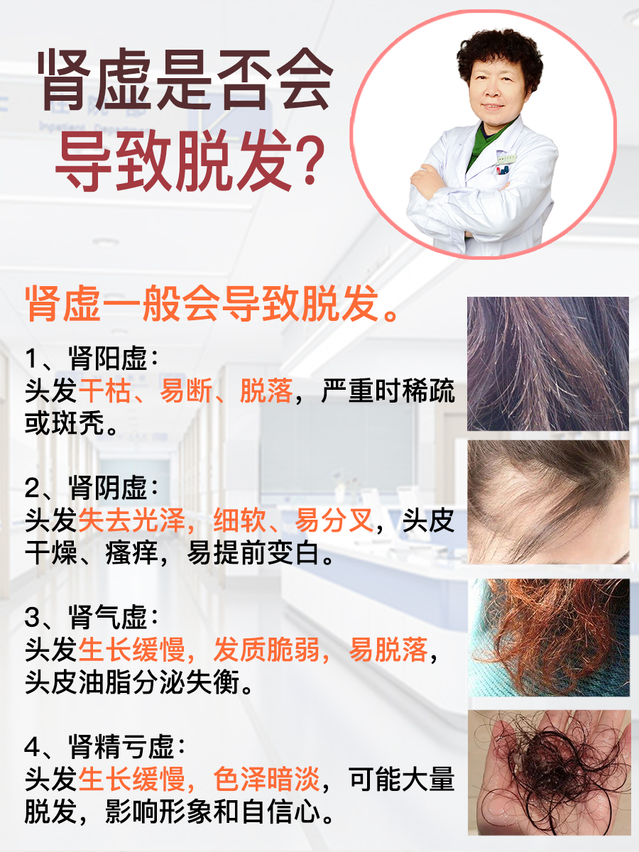 肾虚会导致脱发吗?一文了解