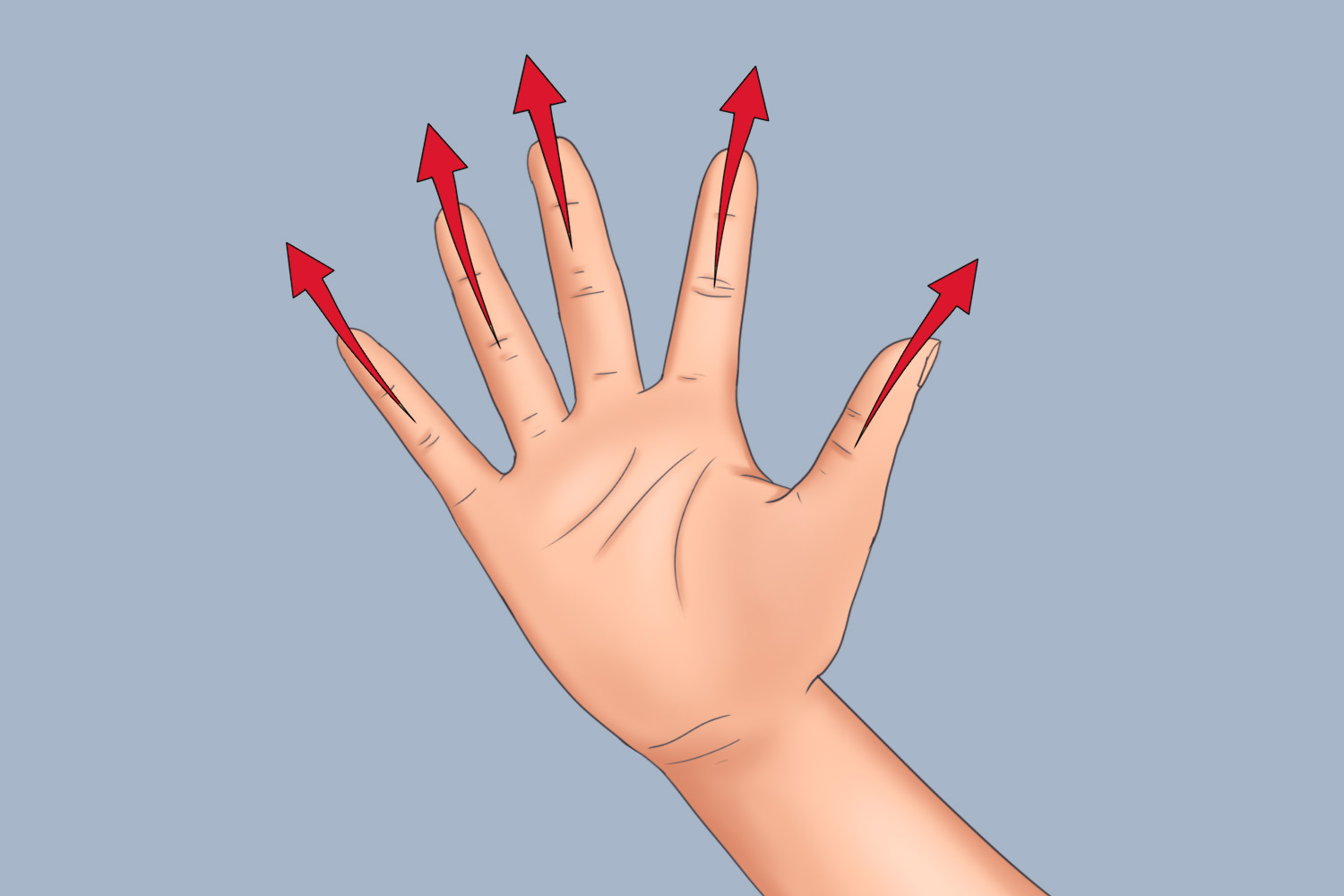 手指肌腱粘连锻炼图