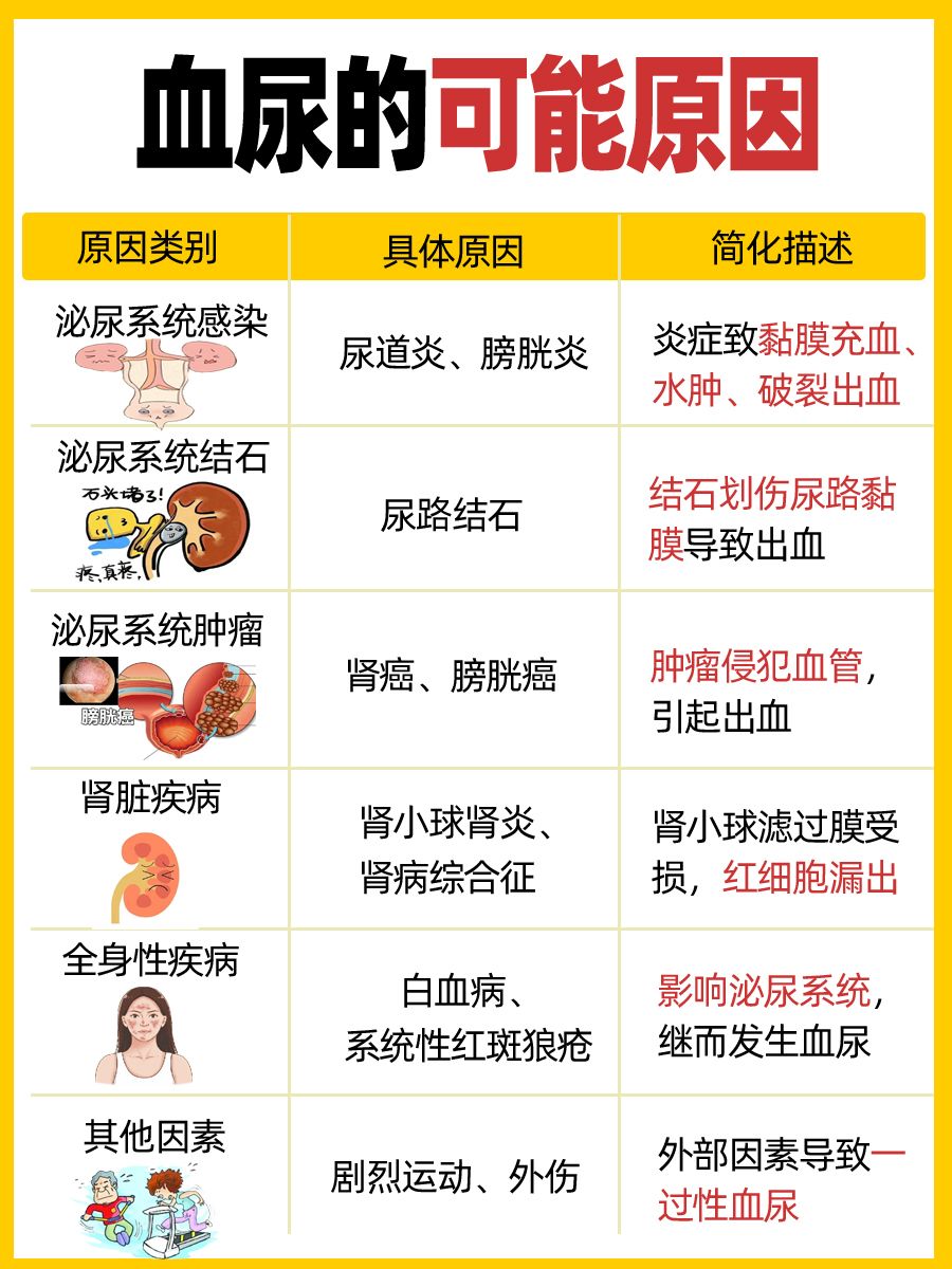 小便有异常？血尿原因大起底