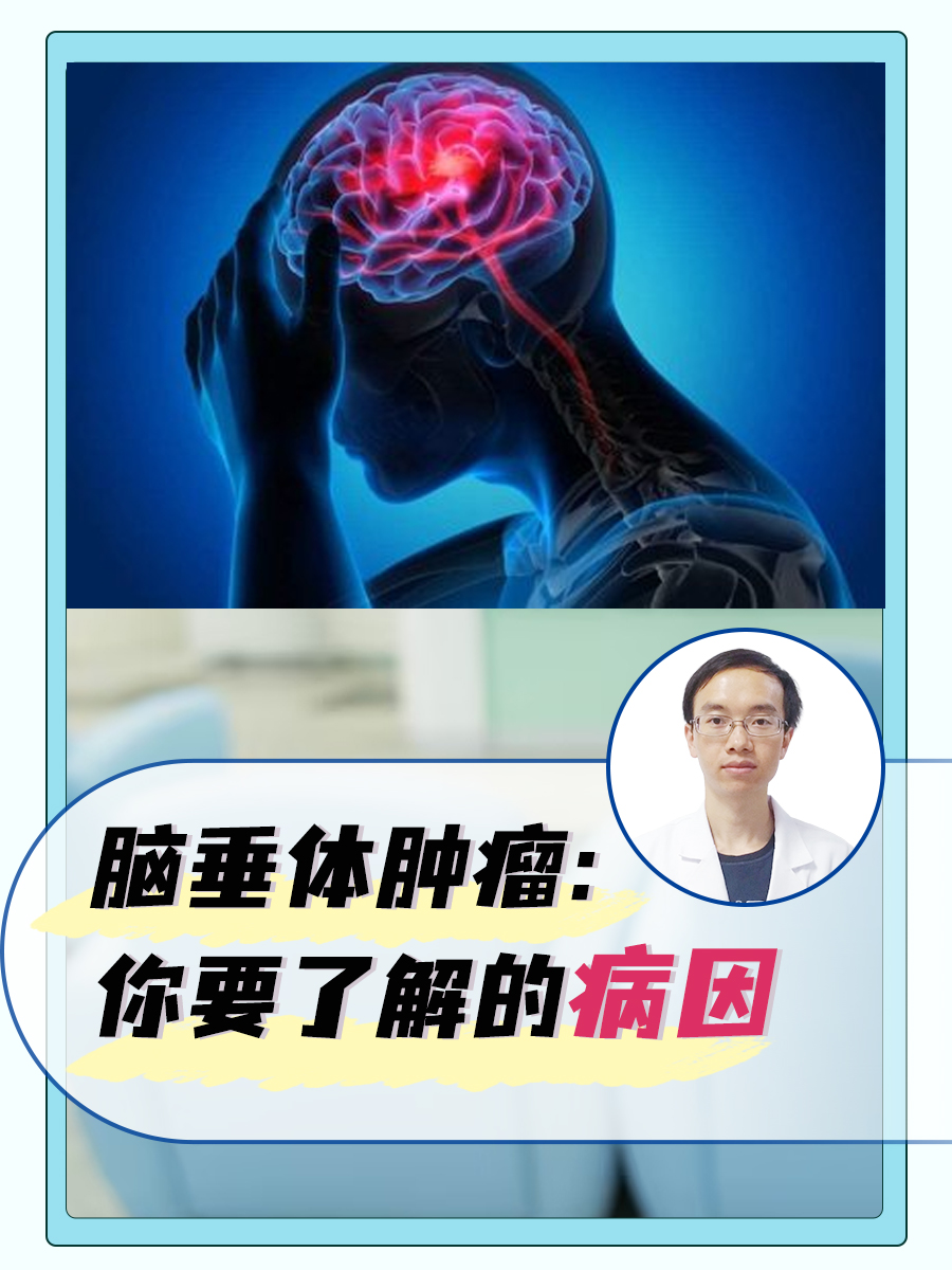 脑垂体肿瘤:你要了解的病因