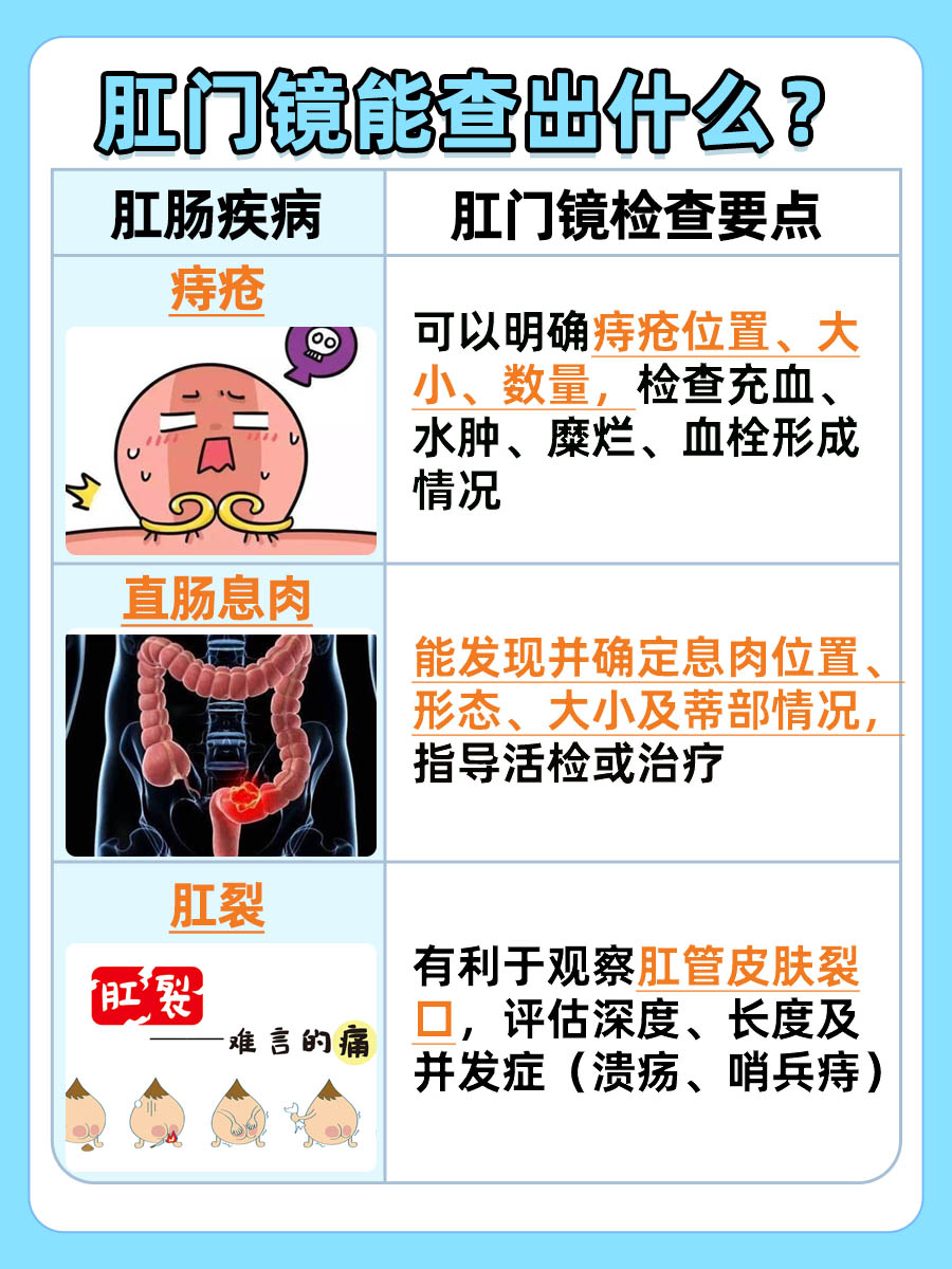 肛门镜能查出什么？一文解析