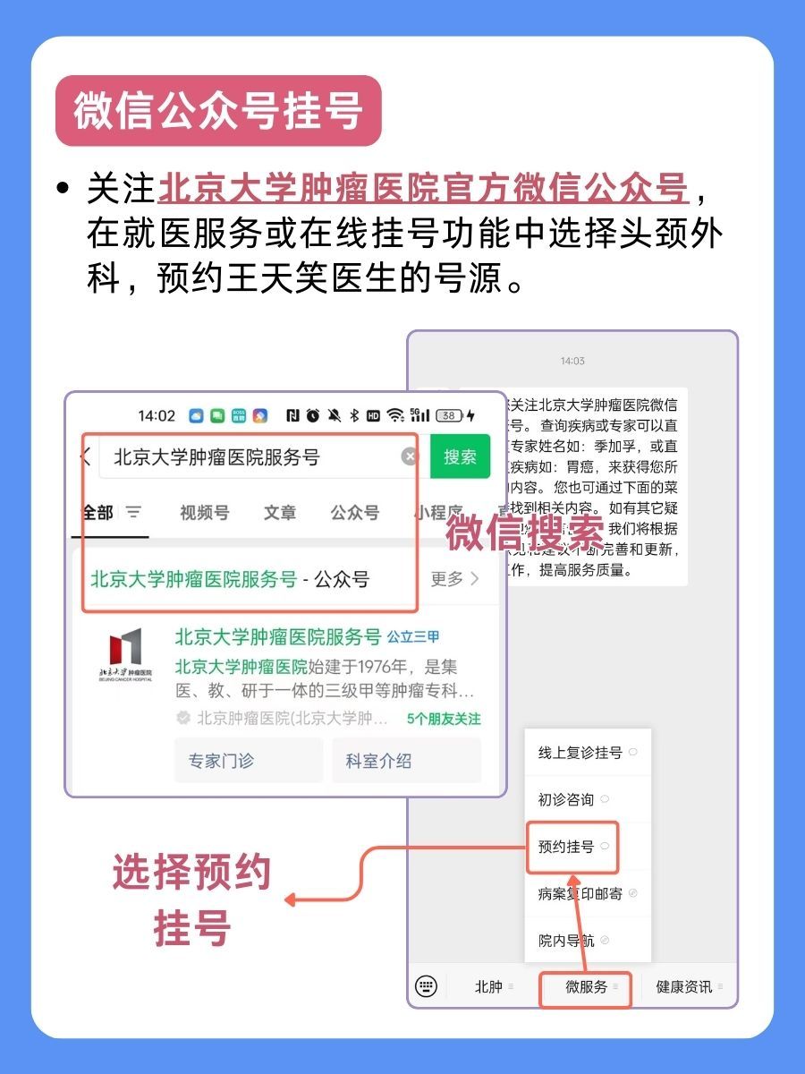 北京大学肿瘤医院王天笑医生怎么样？怎么挂号？