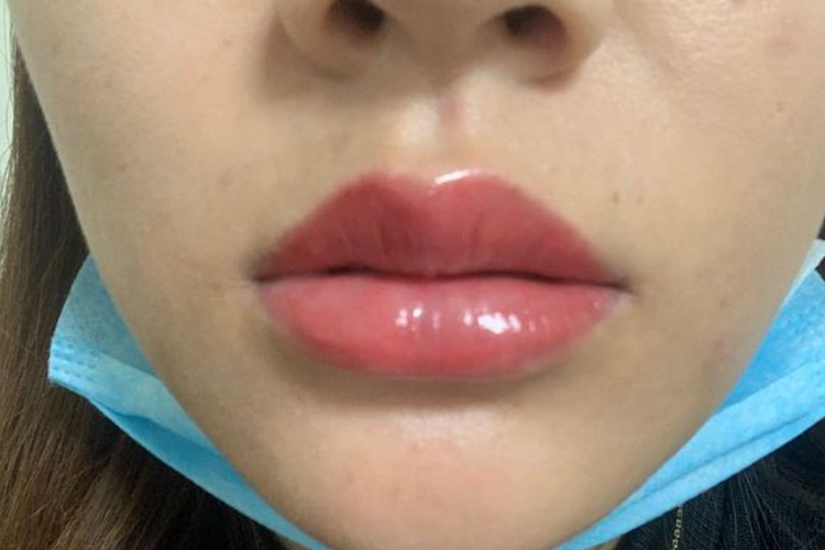 纹唇掉痂第三天图 纹唇掉痂第三天图