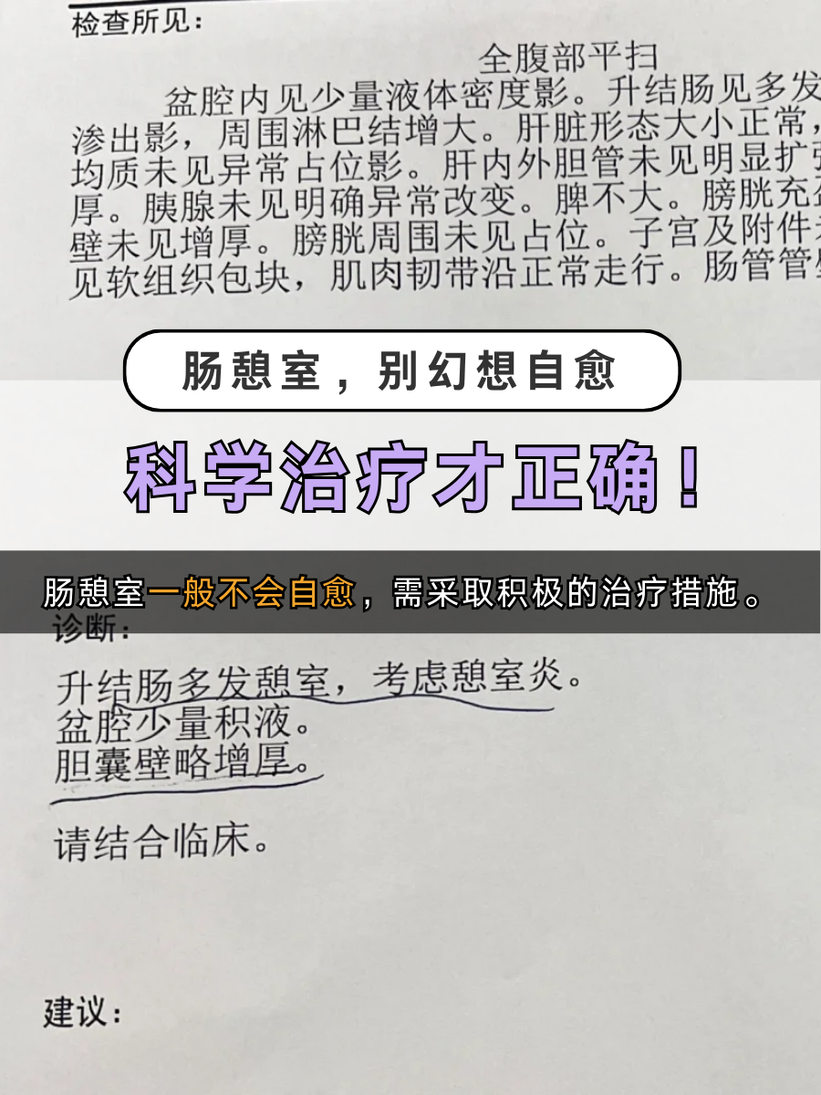 肠憩室，别幻想自愈，科学治疗才正确！