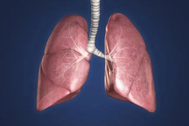正常肺图