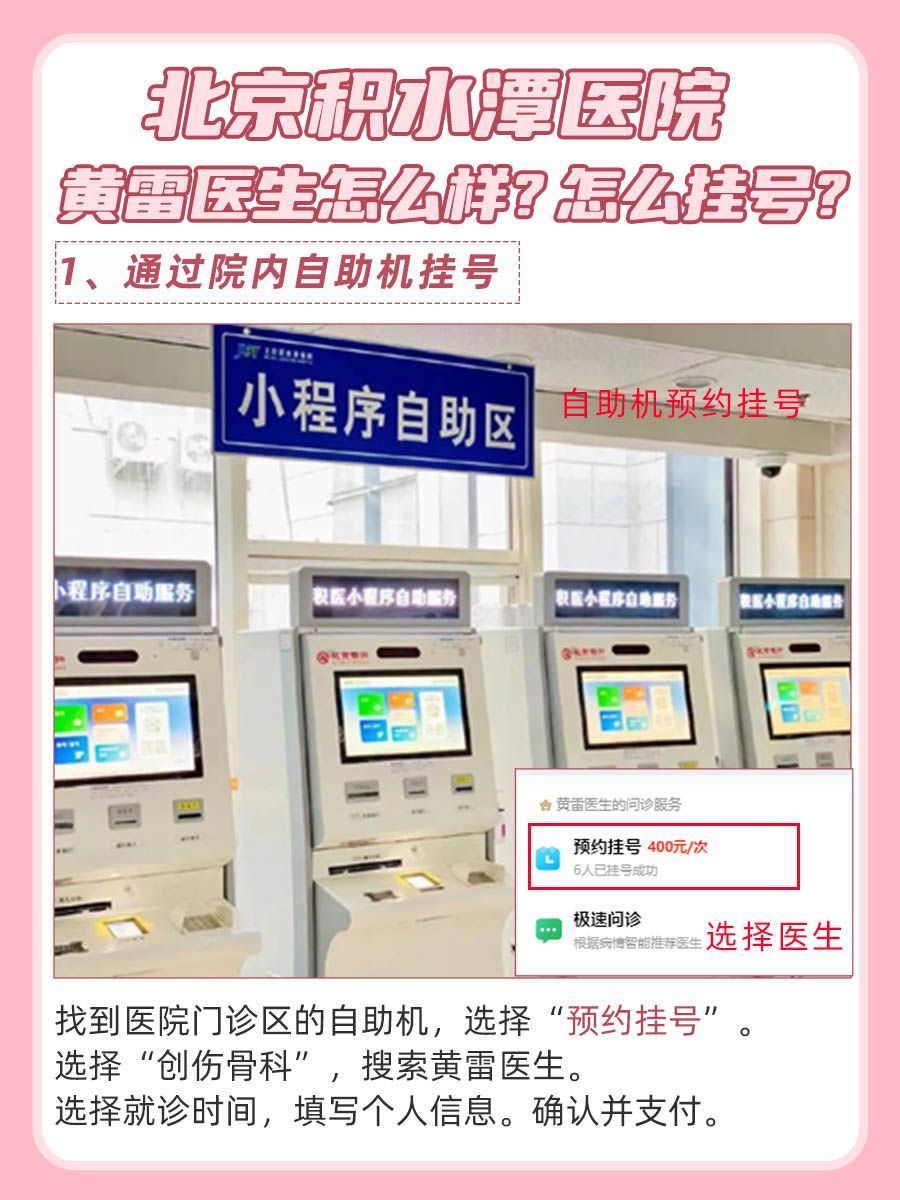 北京积水潭医院黄雷医生怎么样?怎么挂号?