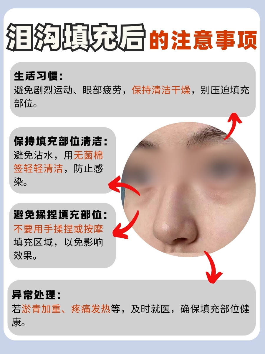 打了泪沟出现淤青,该怎么消除?速进找答案