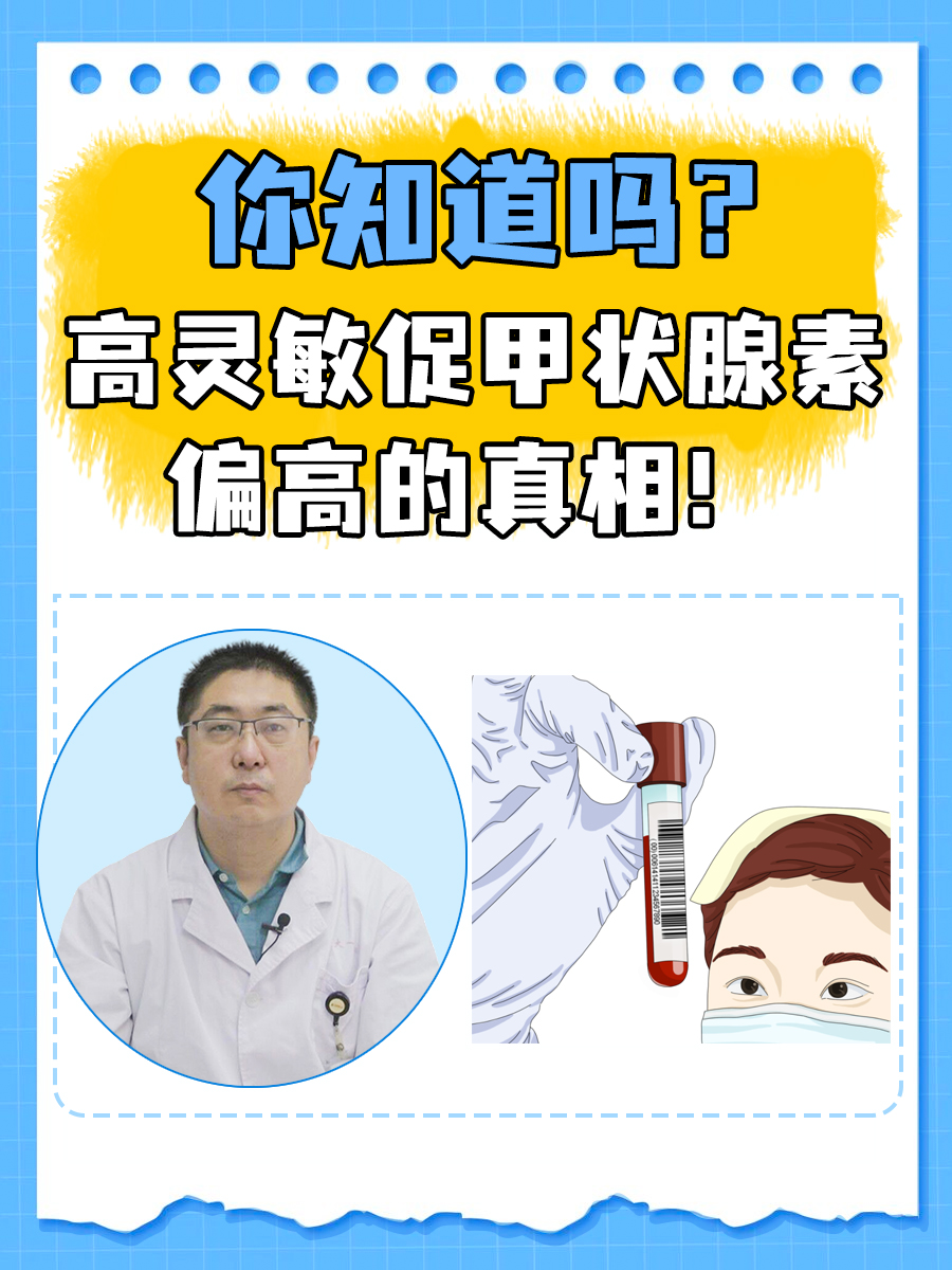 你知道吗?高灵敏促甲状腺素偏高的真相!