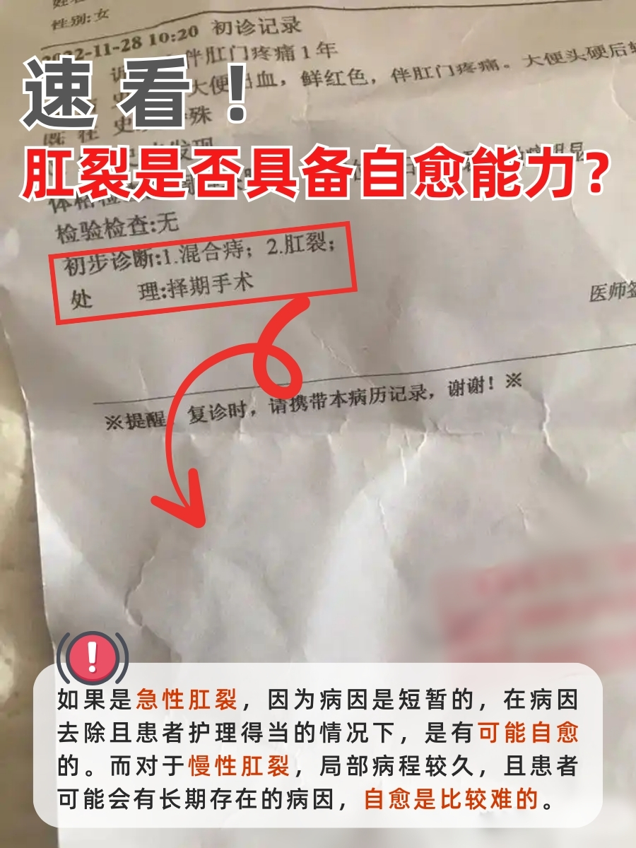 速看！肛裂是否具备自愈能力？