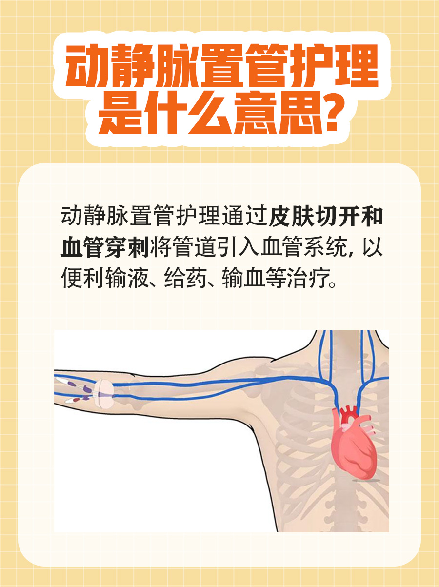 动静脉置管护理是什么意思,一文读懂