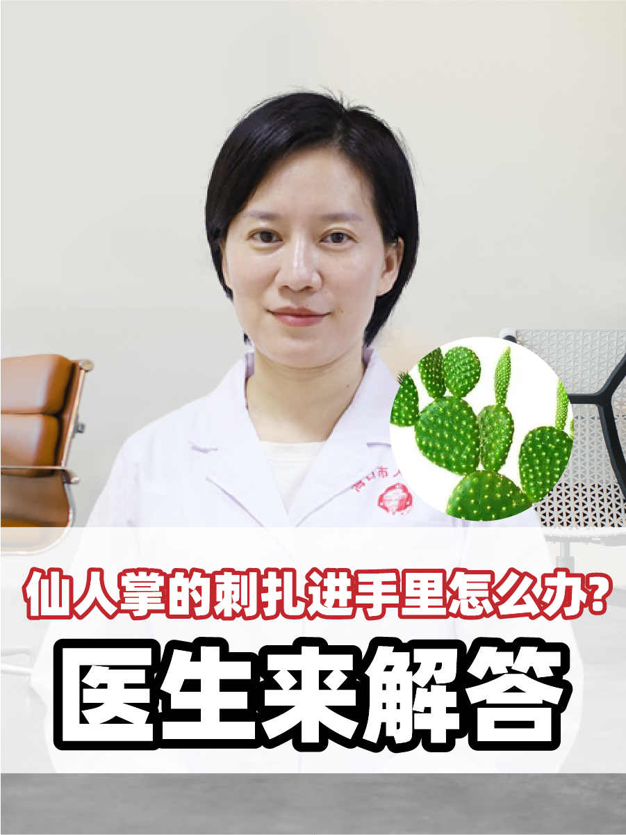 仙人掌的刺扎进手里怎么办：医生来解答