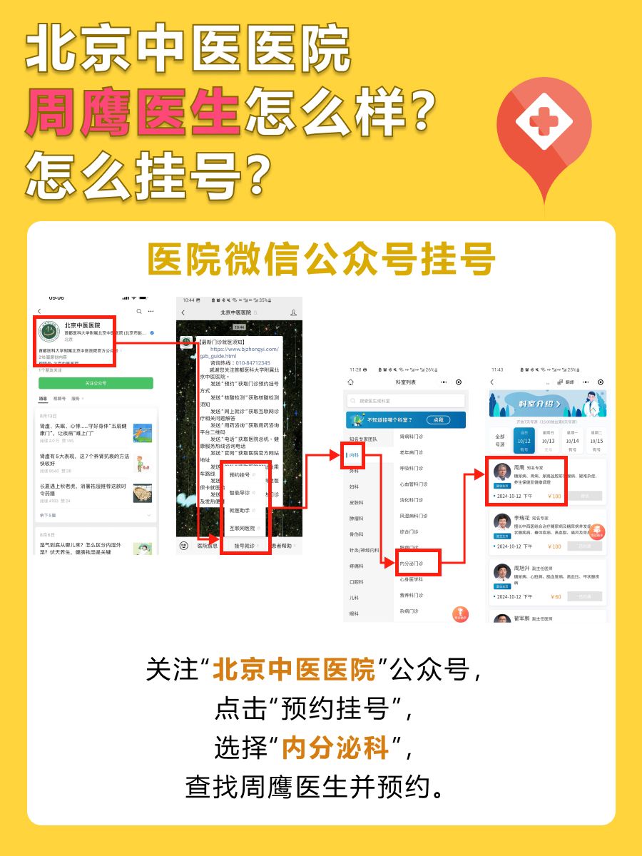 北京中医医院周鹰医生怎么样？怎么挂号？
