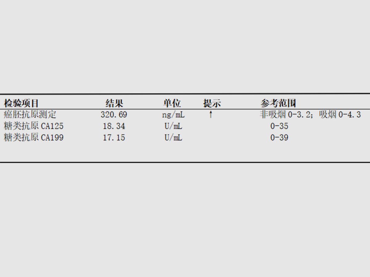 肺鳞癌（中年男性患肺鳞癌，综合治疗效果显著）.png