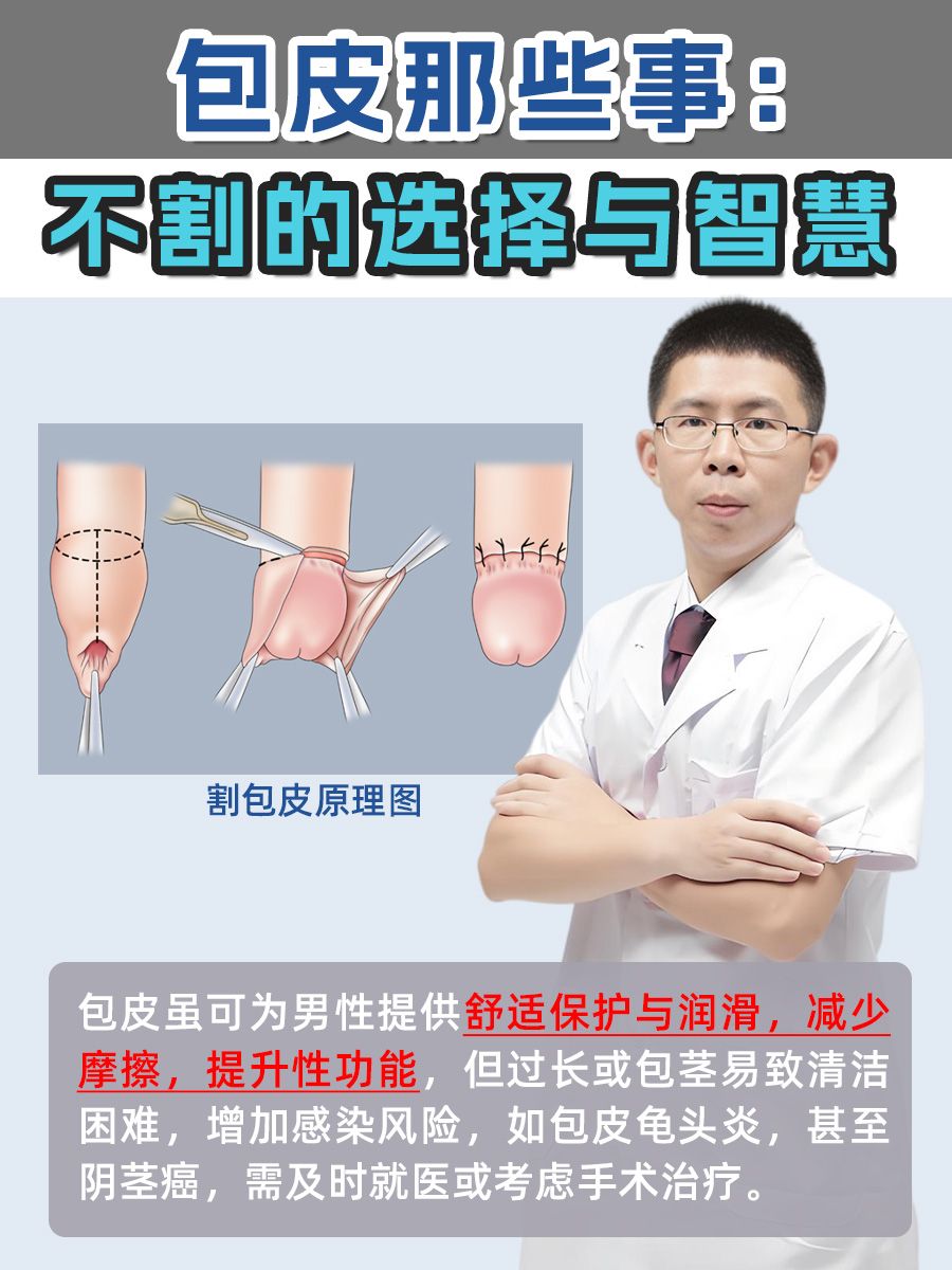 包皮那些事：不割的选择与智慧