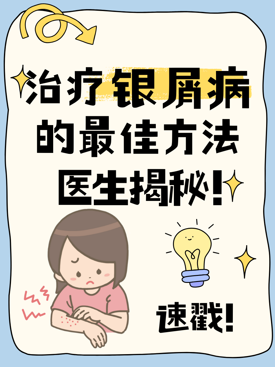 治疗银屑病的最佳方法，医生揭秘！速戳！！