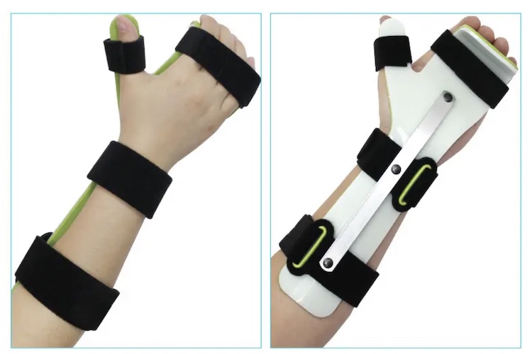 功能性腕关节支具图 功能性腕关节支具图