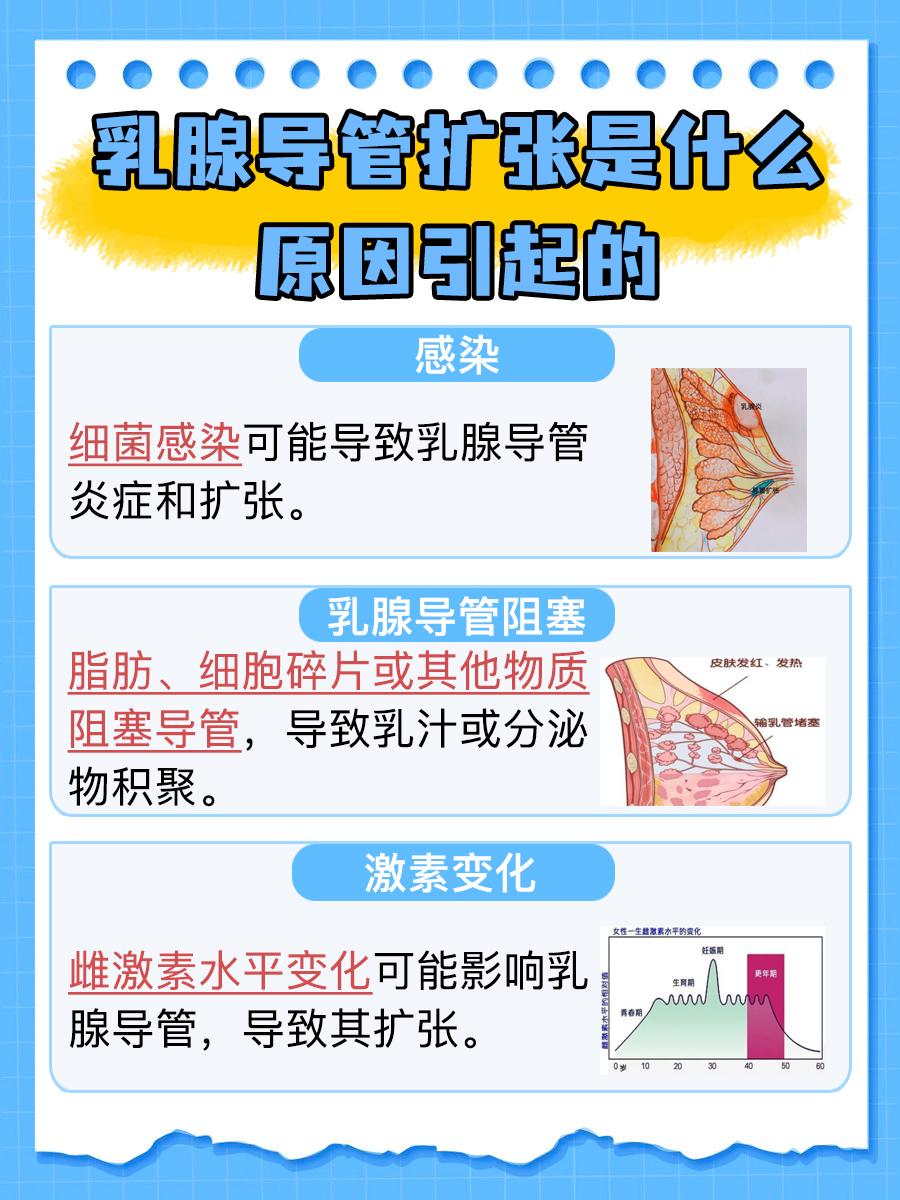 治疗方法揭秘：如何有效治疗乳腺导管扩张