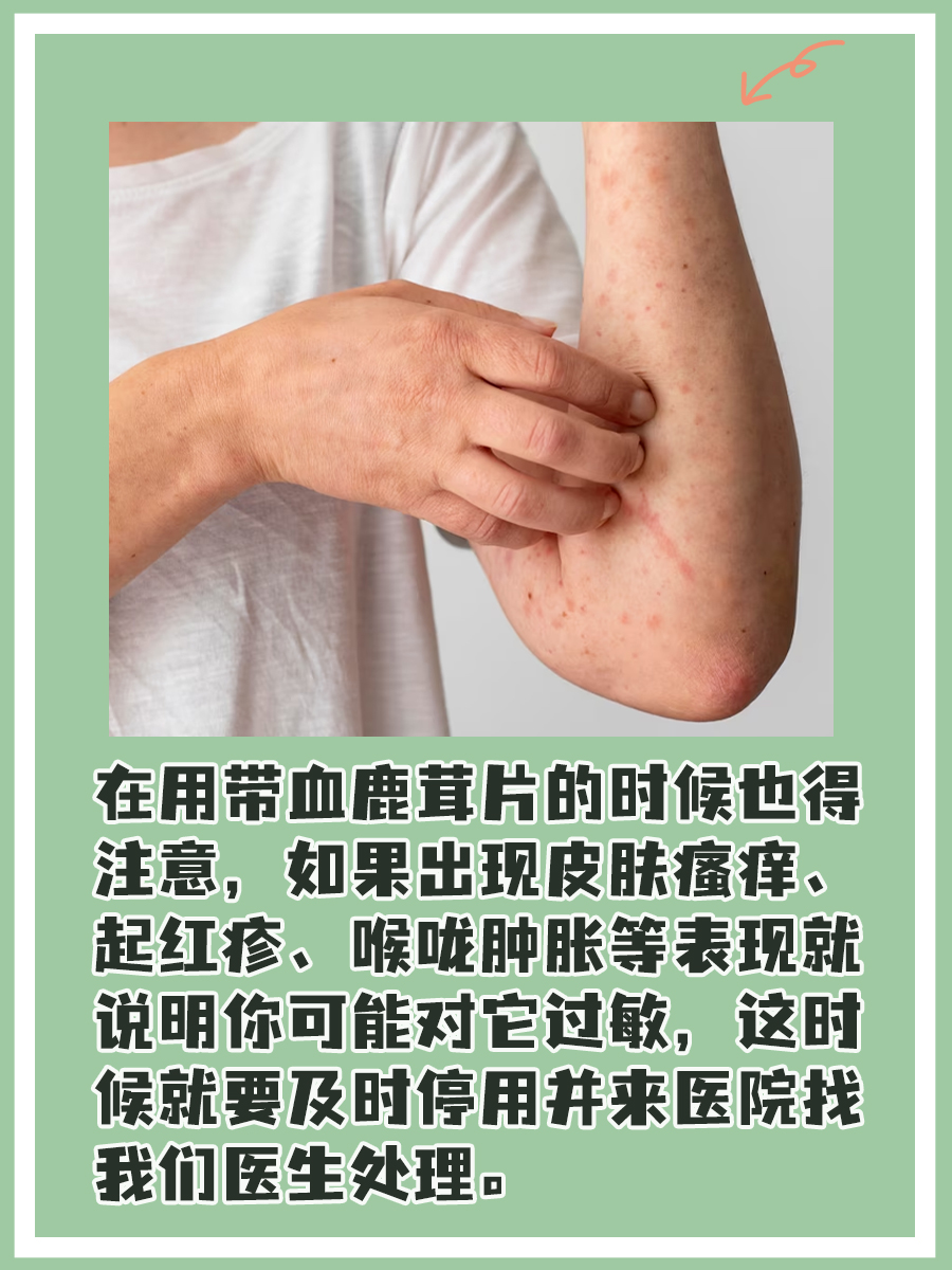 鹿茸血的功用、用法拿捏不到位？医生来教你