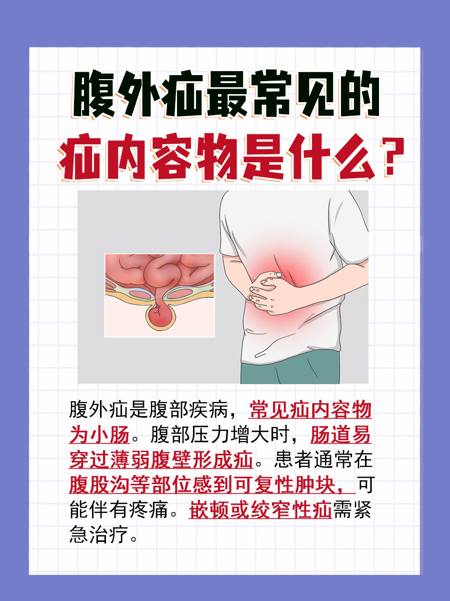 腹外疝常见内容物:一文教你识别