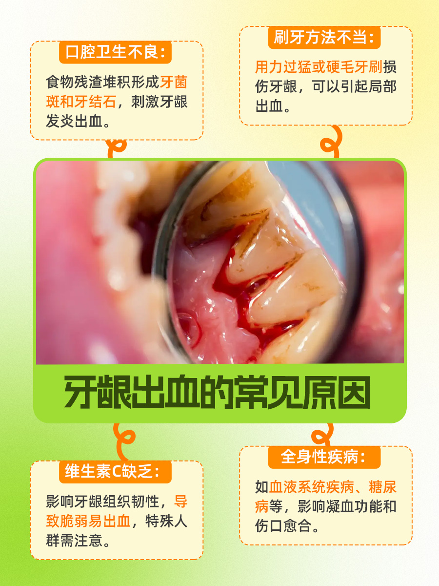 你的牙龈出血，可能藏着这些不为人知的秘密！