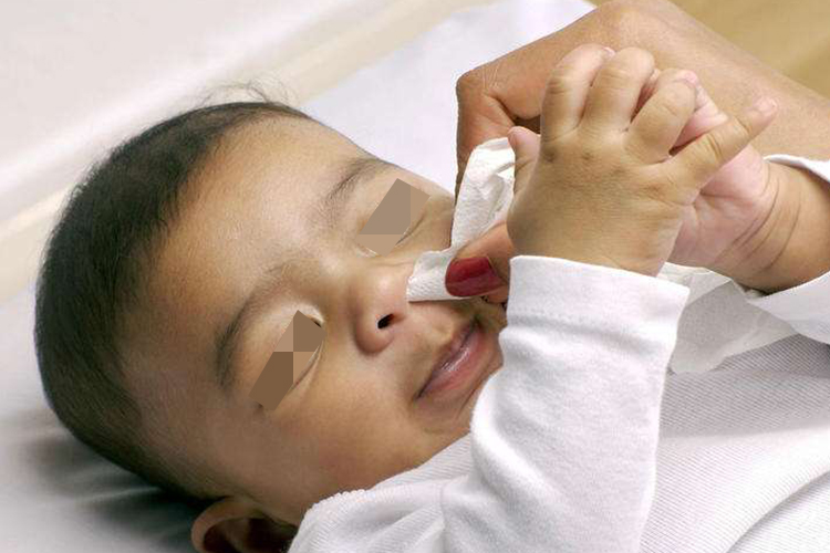 慢性鼻炎宝宝鼻塞图