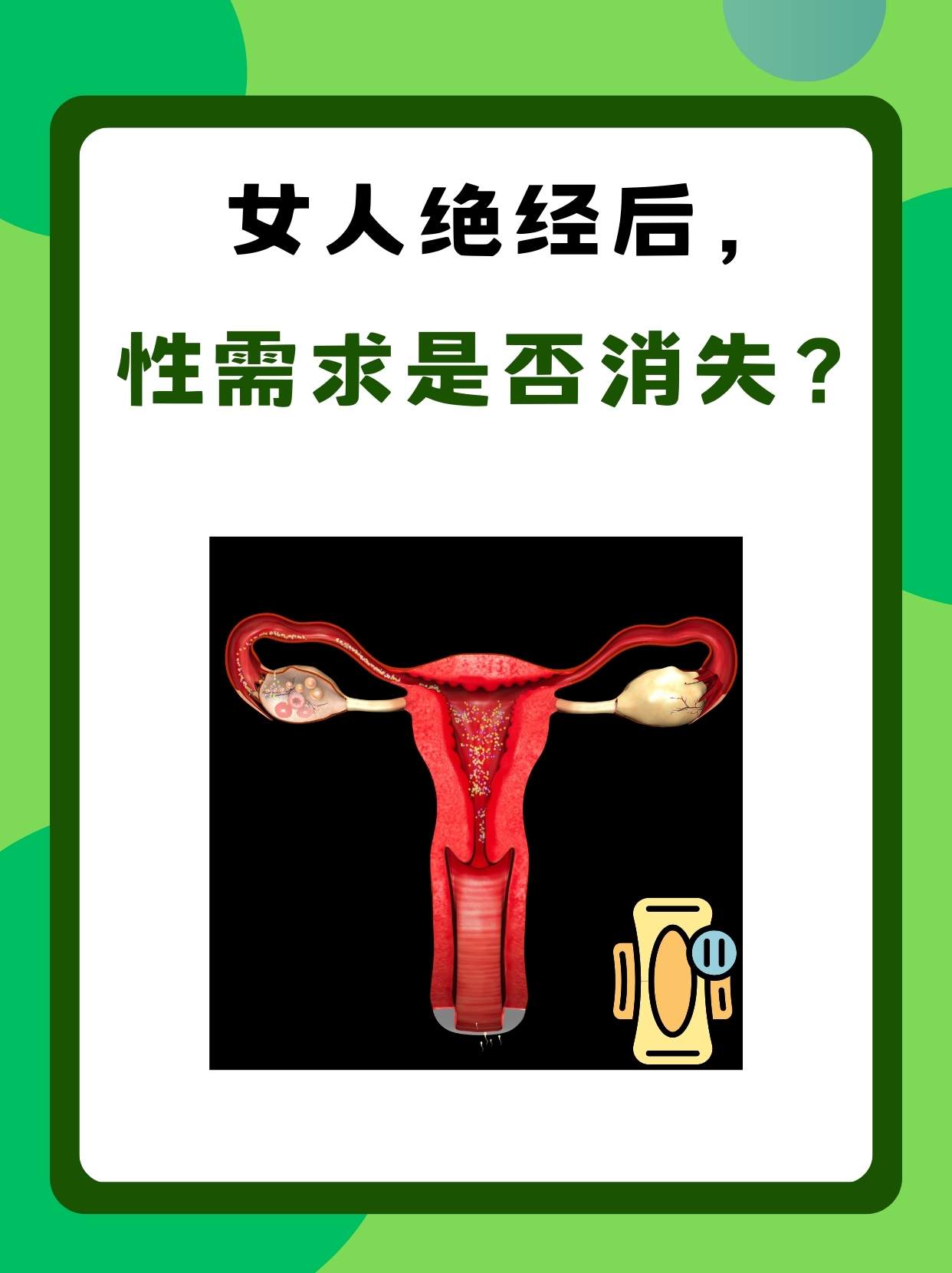 女人绝经后，性需求是否消失？