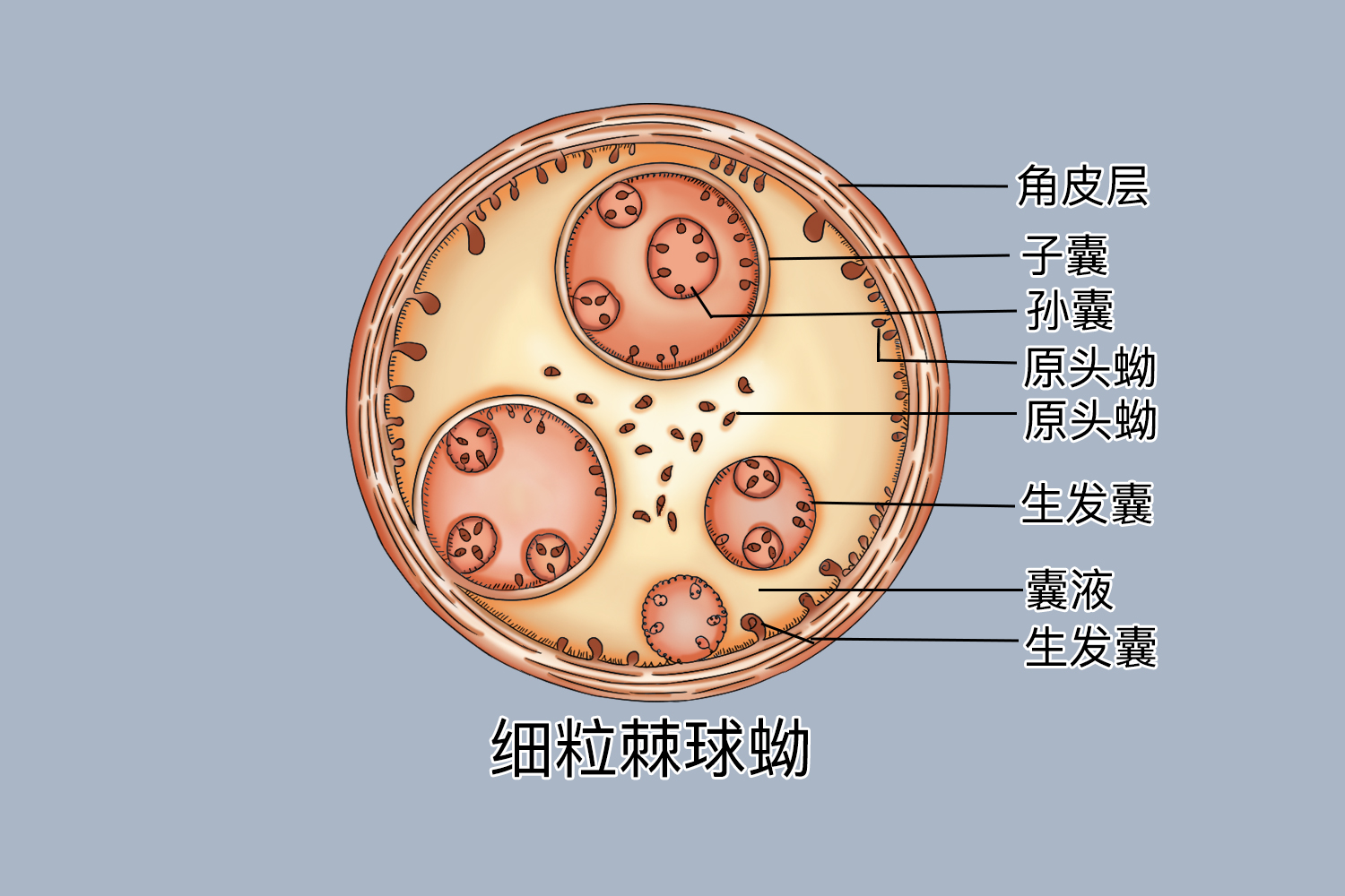 细粒棘球蚴手绘图